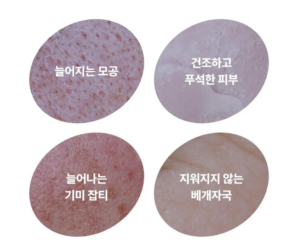 [스무살 앰플] 아이디플라코스메틱 엑소브이 플러스 앰플 30ml 상세페이지 10